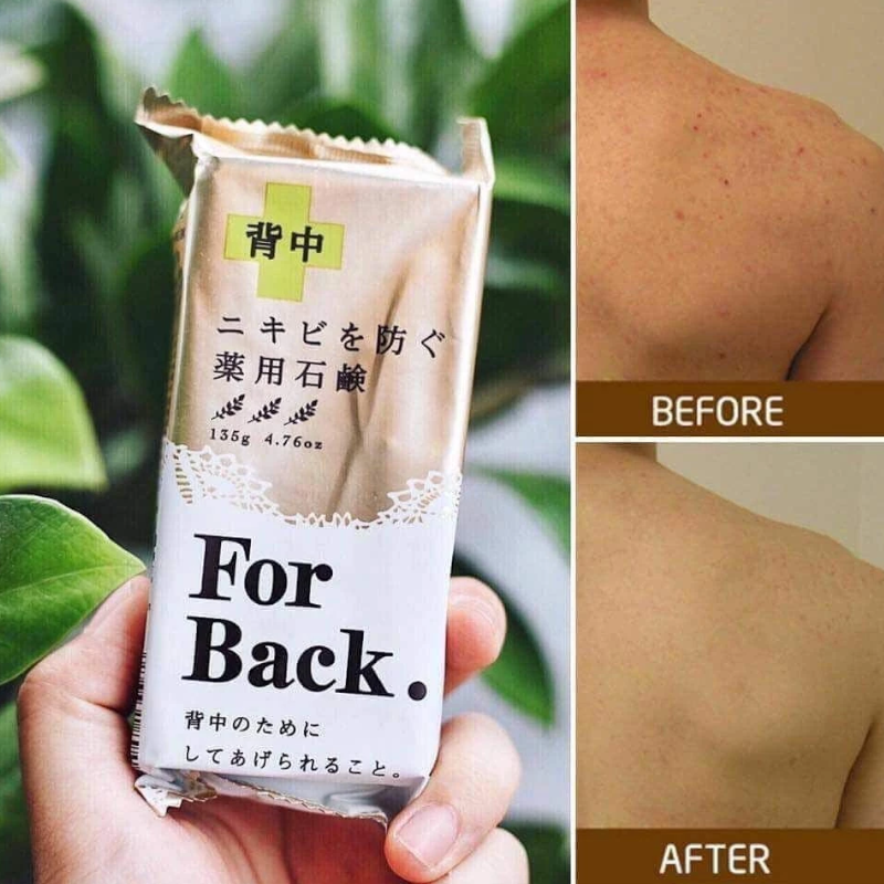 Pelican Medicated Soap 135g For Back – Prevents Back Acne