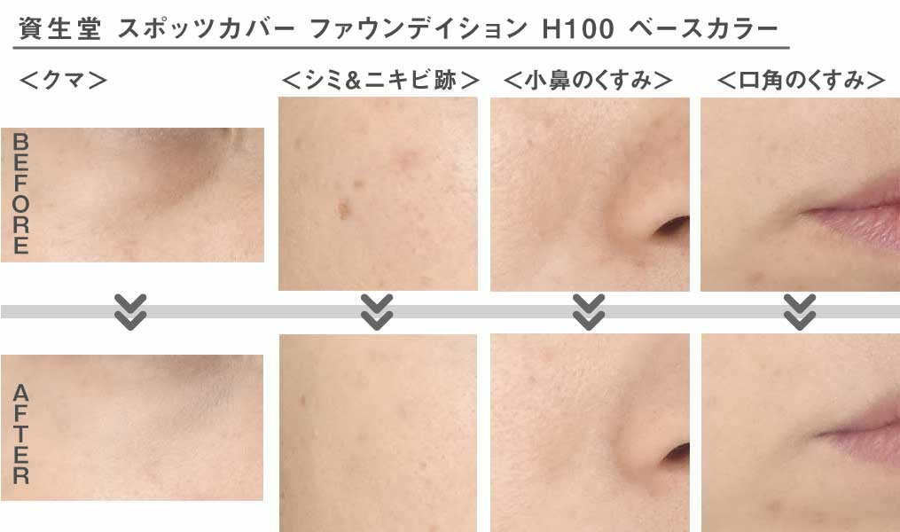 Shiseido Spotscover Foundation 20g/0.71oz - H100: light skin tone